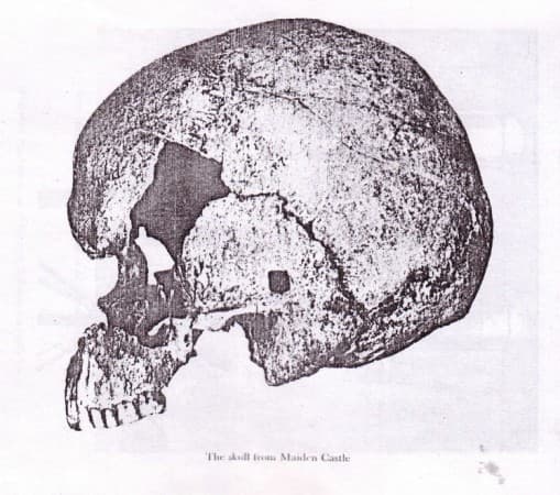 maiden-castle-skull11-509×450